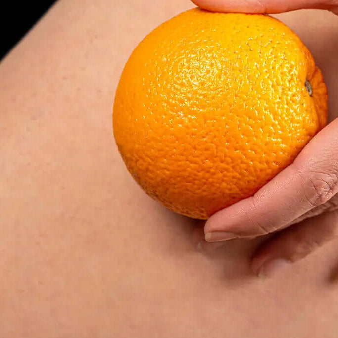 Guía Completa sobre Masajeadores Anticelulíticos: Beneficios, Tipos y Uso Correcto