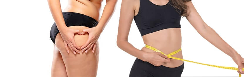 ¿qué es la celulitis? ¿Y como se puede prevenir?